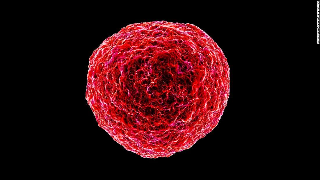 Mjekët ngrenë alarmin e përhapjes së një infeksioni të afërt me virusin HIV